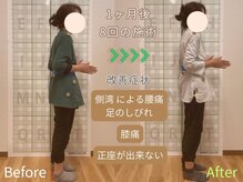 ほねつぎ極癒/【猫背矯正 ＋ EMS】