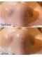 トータルビューティーサロン シフォン(Cfon)の写真/【暑い季節の頑固な毛穴汚れ徹底洗浄】結果重視のお悩み別ケア