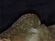 ブライダルベールトータルビューティ(BRIDAL VEIL total beauty)/毛穴の汚れ・角質◎ピーリング