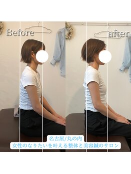 ハルノハナ鍼灸治療院/改善例♪