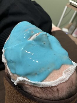 ミヨン(Miyong)/volayonヒアロテン管理