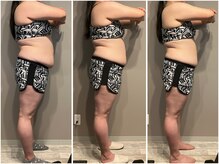 インプルーブ 浜北店(Improve)/2ヶ月で体重-9.9ｋｇ!　20代女性