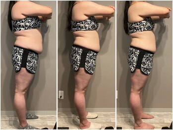 インプルーブ 浜北店(Improve)/2ヶ月で体重-9.9ｋｇ!　20代女性