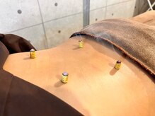 ハリトマト 梅田中崎の雰囲気（【血行促進】お灸の温もりで身体の巡りを整え不調にアプローチ）