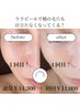 韓国肌管理No１！ララピール！40代から始めるつや肌改革！ピカピカに【岐阜】