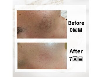 サロン ルイ(salonRui)