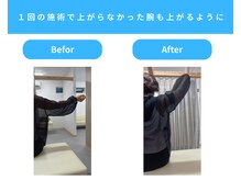 きくち整骨院/物をとるのが楽に