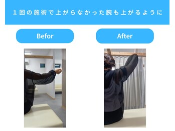 きくち整骨院/物をとるのが楽に