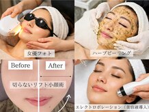 モンロー(MonroE+)