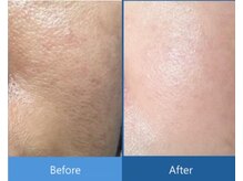 ローズドゥシャロン(Rose de CHALON)/毛穴・くすみも改善★