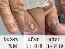 ココアリス(cocoAlice)の雰囲気（爪いじりをしてしまう方もたった1～3ヶ月でこの変化！）