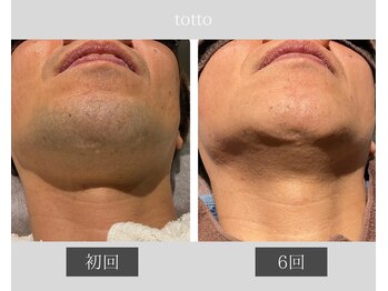 サロントット(salon totto)/before→after