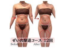 ハナチュチュ 矢場町店(Hanachuchu)/