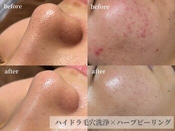 ヒナノ 矢場町店(HINANO)