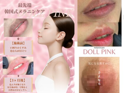 カロン(Kalon)の写真