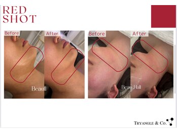 アンシャンテ(Anchant)/【レッドショット】