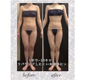 メディカルエステサロン ローズ 鯖江店(ROSE)