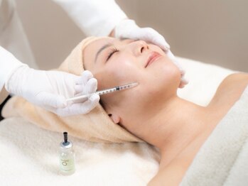 リノア 柏(Lino'a)の写真/毛穴汚れごっそり洗浄!毛穴ケア×ピ-リングの新常識★ハイドロフェイシャルで高濃度水素毛穴洗浄+リフトup!