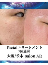 メンズサロンアール(AR)/プロセルセラピーズ