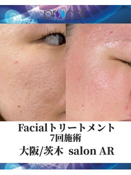 メンズサロンアール(AR)/プロセルセラピーズ