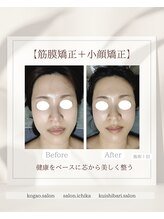 イチカ 仙川店( ichika)/全身から調整　筋膜矯正