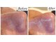 ハロネ(Halone’)の写真/肌質改善で透明感あふれる美肌へ。毛穴のお悩み原因は人それぞれ。一人一人に合わせた毛穴ケアをご提案◎