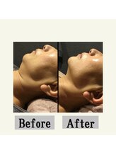 ペールノエル 富士宮店(PERENOEL)/インディバ,サーモ(50代女性)