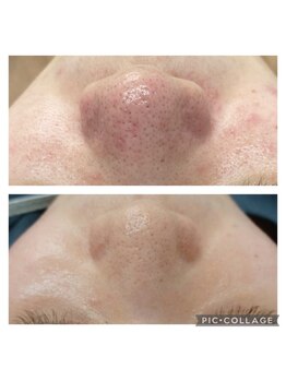 ビラ ベルダ(Bira Beldad)/