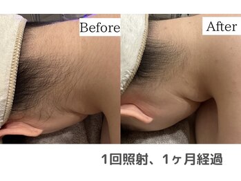 セオリー(Theory)/Before After