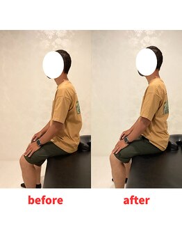 ナオル整体 福岡香椎院(NAORU整体)/30代男性施術事例【猫背改善】