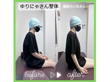 とるこり美姿整体院 新宿院の雰囲気（《肩周りの施術》首・肩こり、巻き肩、猫背もスッキリ！）