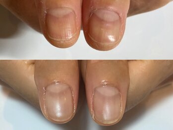 キラネイル アンド アイラッシュ by World Beauty(KIRA)/自爪育成