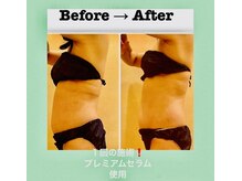 サロン ド マナ(Salon de Mana)/セル脂肪を燃焼&分解!