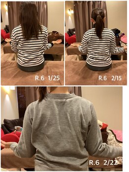 ヴィラ整骨院/ヴィラ整体☆五十肩の改善