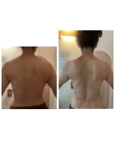 アール(R)/テスラセラピー1回の効果！