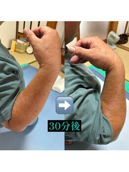 古式腱引き 甘田道場/肘が曲げづらく、肩に付けない