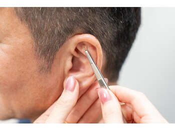 ミドコロ(midocoro)/男性でも耳ツボダイエット♪