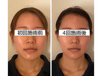 キュープ 鹿児島伊集院店(Qpu)/