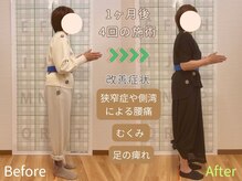 ほねつぎ極癒/【猫背矯正 ＋ EMS】