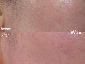 アイロンボーイ(IRONBOY)/艶肌お顔全体WAX