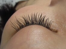 グラッシー(Glassy)/施術後２週間