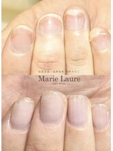 マリーロール 天王寺店(Marie Laure)/自爪育成/深爪矯正/ネイルケア