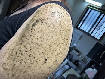 コハク(kohaku)/二の腕のザラツキのお悩みにも!