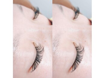 エネル バイ アルト(eneru by arto)/バインドロック