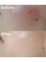 ラ ジェム(La gemme)/【トロイアルケ】