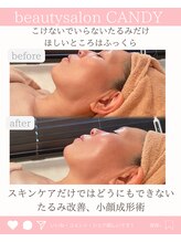 ビューティーサロン キャンディ 海老名(Candy)/