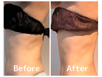 美活ラボ(美活LABO)/ビフォーアフター