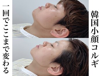 リベルキョウト 京都駅前店(Liber Kyoto)/韓国小顔コルギ