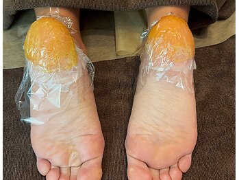 ラヴァコケット 南草津店(Lova'coquette)/かかとのガサガサにもマスク