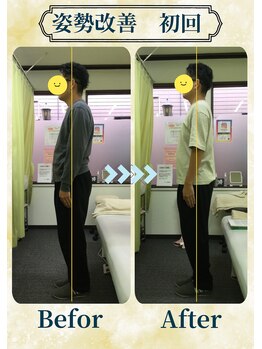 アミーゴ整体院/ビフォーアフター